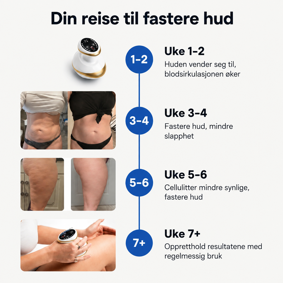 Elektrisk vakuummassasje med varme – massasjekopp for hjemmebruk